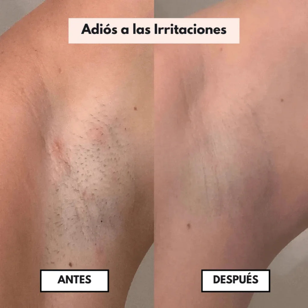 DEPILADORA ZENTORA™ 2-EN-1 IMPERMEABLE: TU PIEL DE SEDA SIN DOLOR 🌸✨
