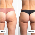 Celluless MD: Sistema de Vacumterapia Anticelulitis