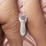 Celluless MD: Sistema de Vacumterapia Anticelulitis